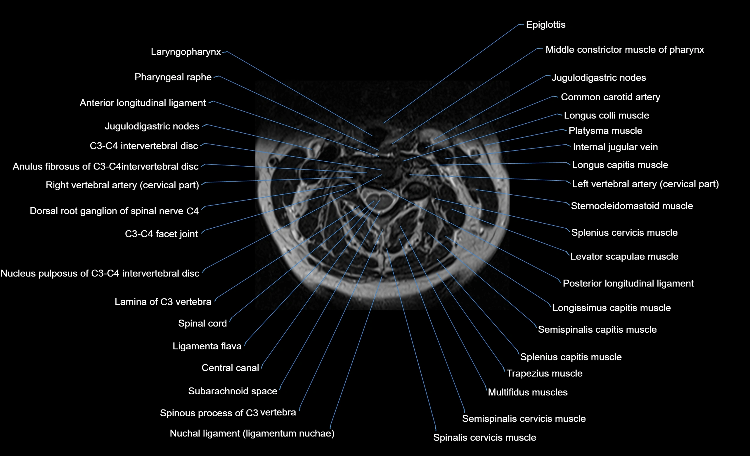cervical spine cross sectional MRI anatomy  3T MRI axial  image-img-00001-00019.webp